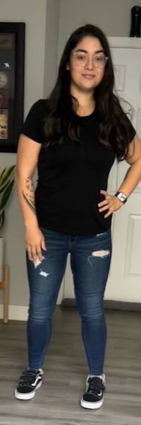 After image of weight loss surgery After image of weight loss surgery